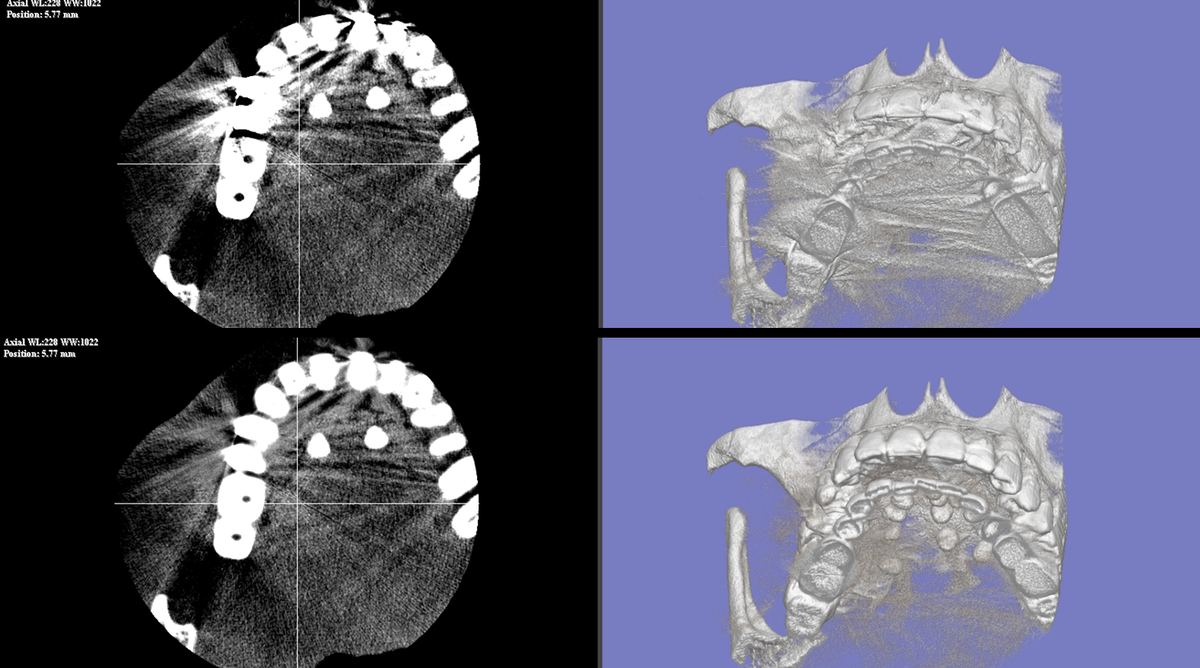 D-MAR 症例B Before/After