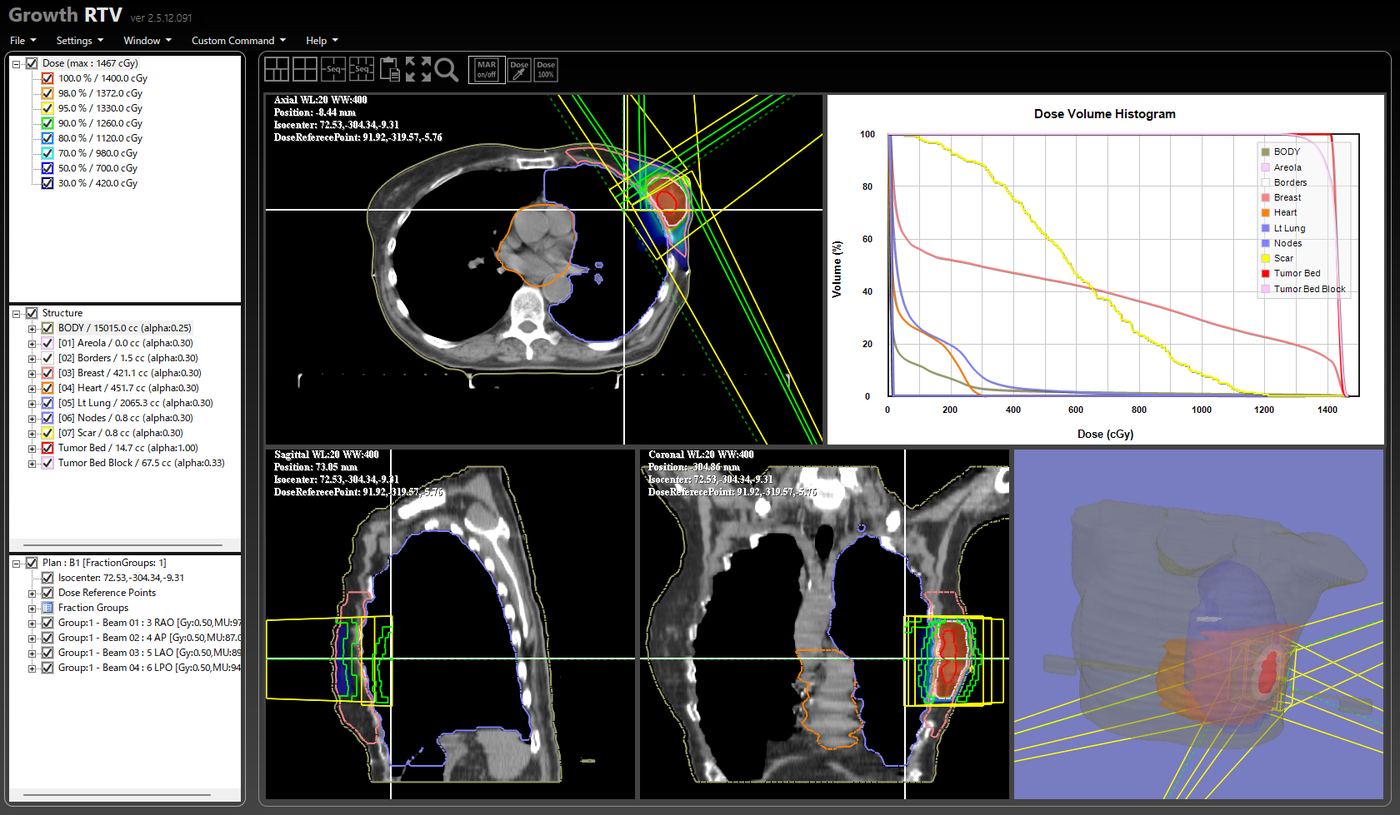 Growth RTV - DICOM-RT解析ソフトウェア画面