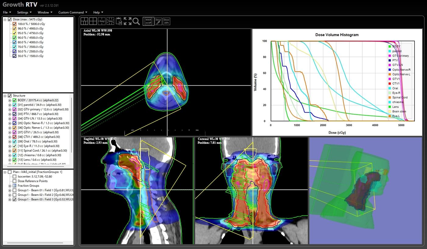 Growth RTV 放射線治療計画UI